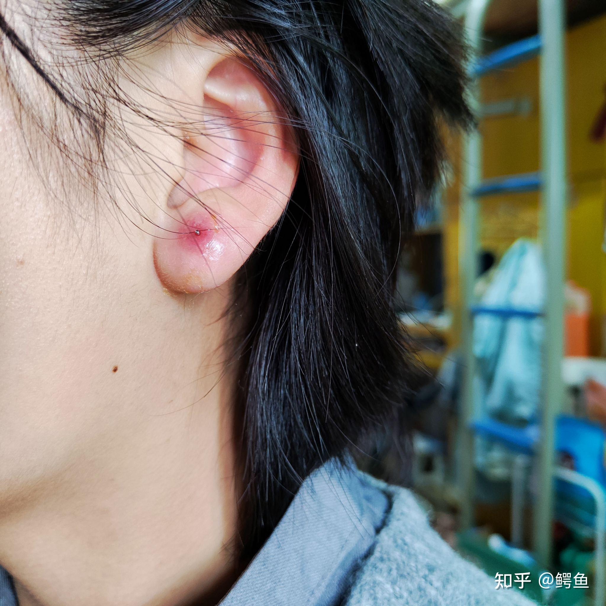 打耳洞悲喜历程