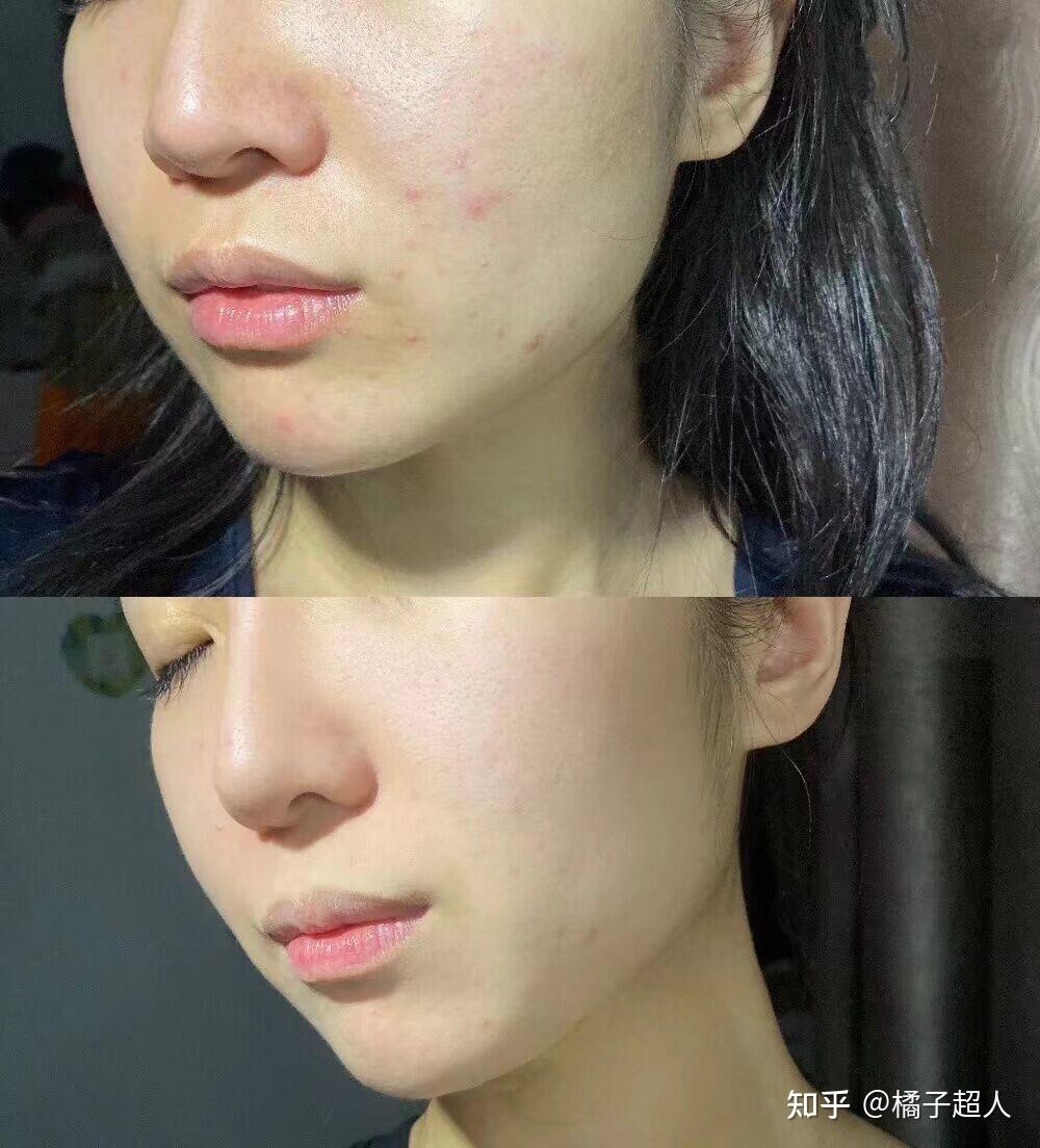 女生怎么养成干净脸,怎么变白?