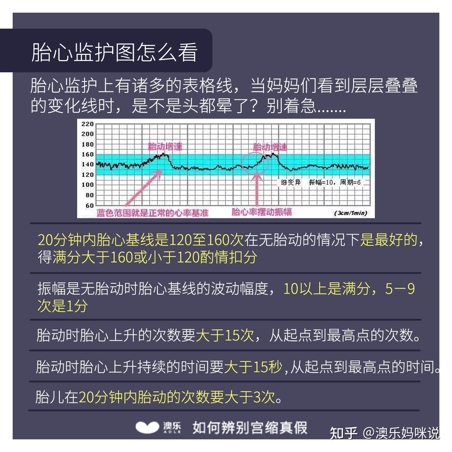 假性宫缩图片曲线图图片