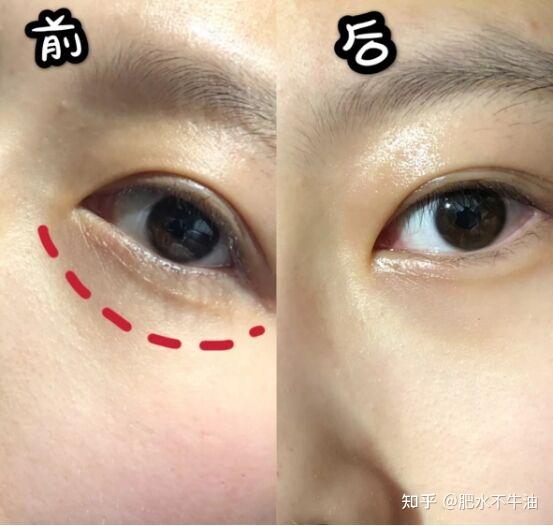 夏天到了怎么防晒和美白