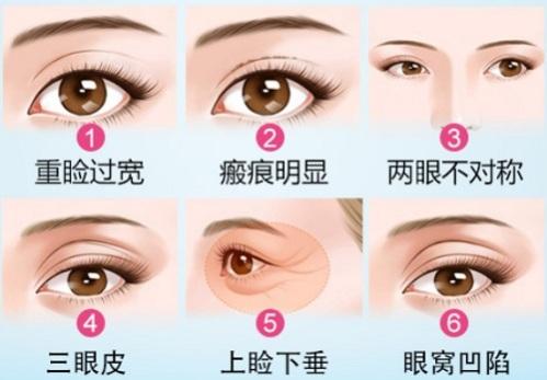 v2-eae0dbf25314cd0505570cdd0fee4e2a_1440w.jpg?source=172ae18b
