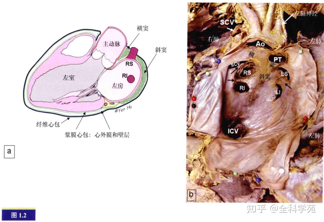 心脏解剖与影像概述:心脏的毗邻结构和附近的易损部位 - 知乎