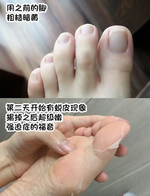 足膜推荐 足膜好物分享 知乎