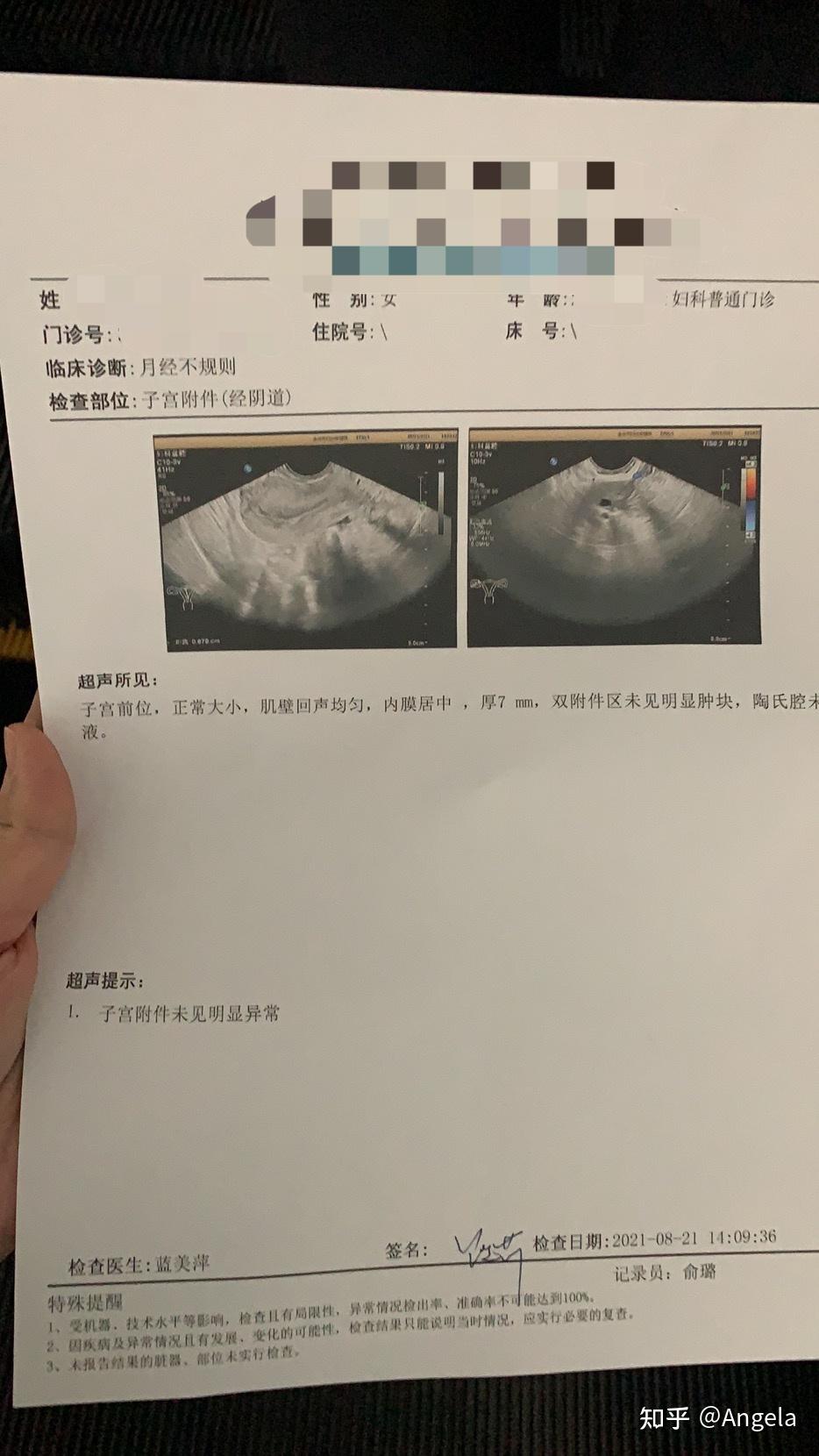 藥流後殘留歷經兩個月終於正常