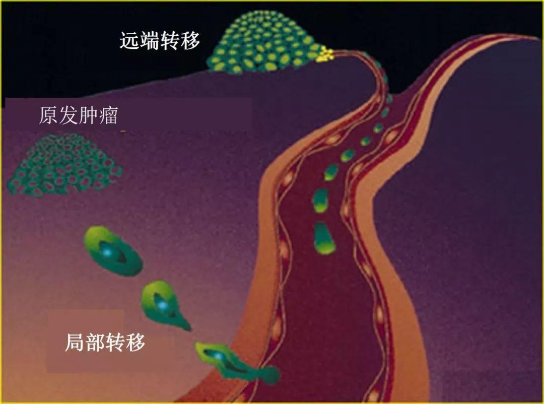 人类为什么至今都无法攻克癌症，达到治愈癌症？ - 知乎