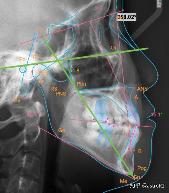 口腔 / 我和口腔科的故事