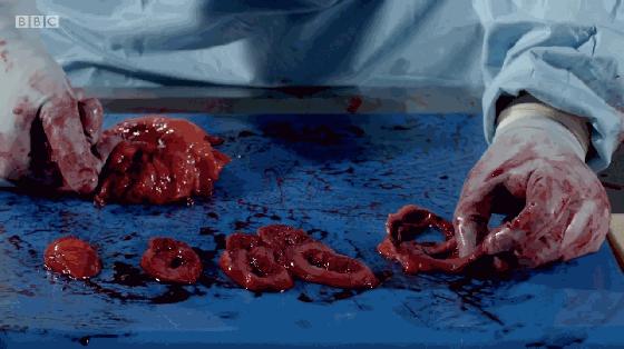 看完这部纪录片你还敢再胖下去