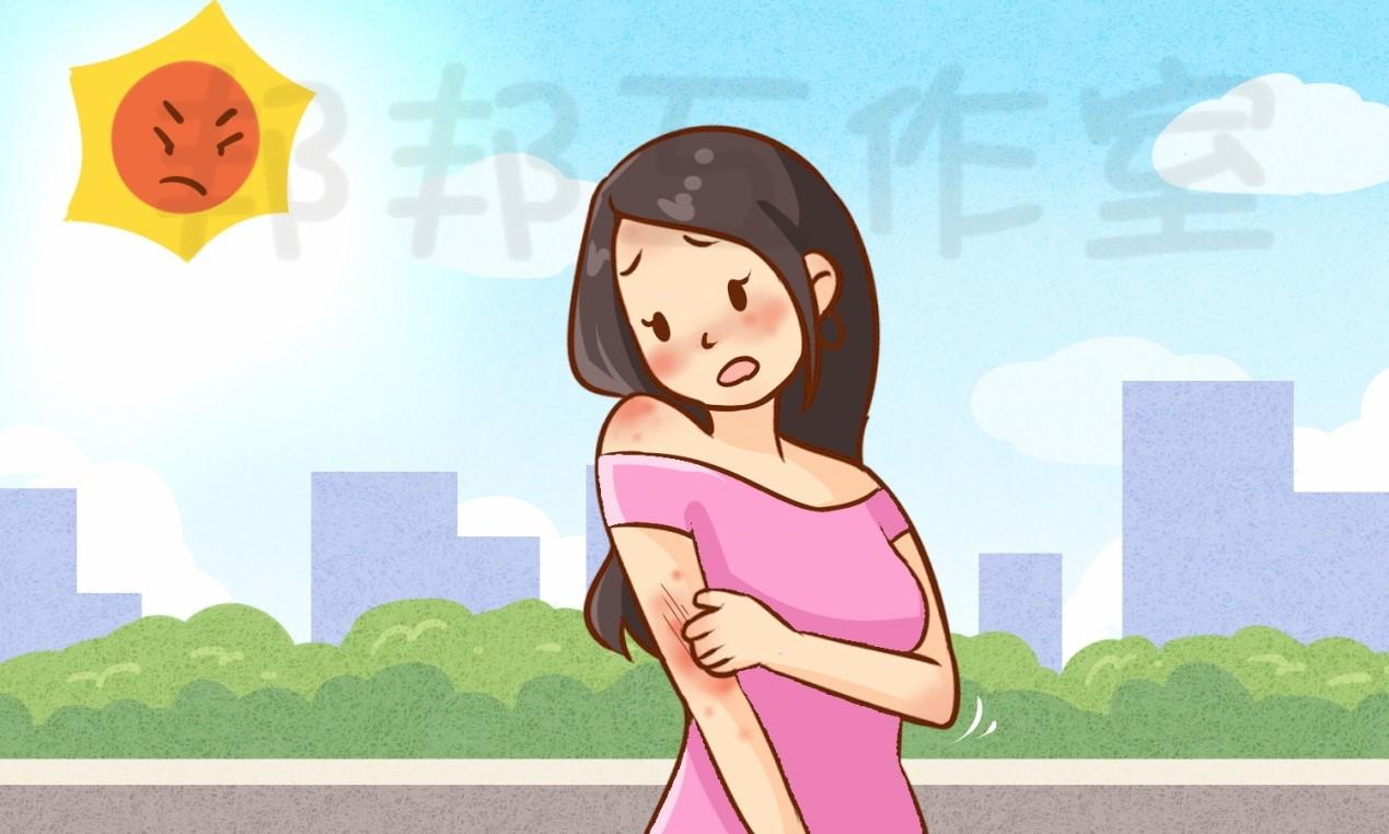 太阳一晒皮肤就发痒日光性皮炎怎么办