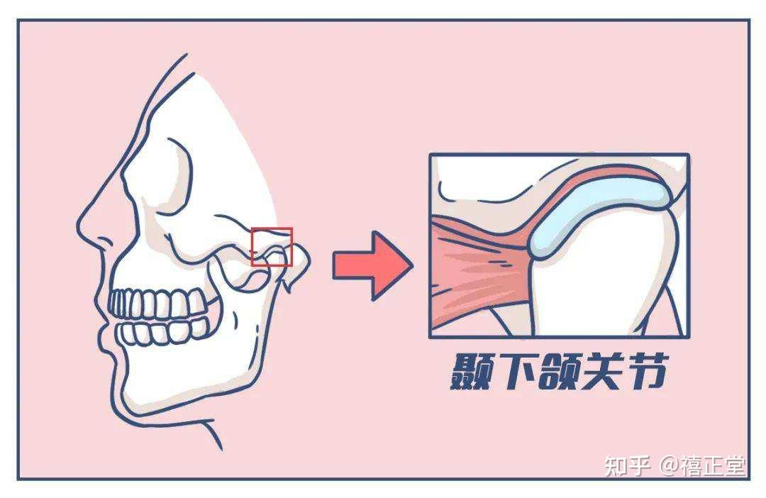 嚼东西就疼，张嘴总能听到咔咔声，原因竟是颞下颌关节！ - 知乎