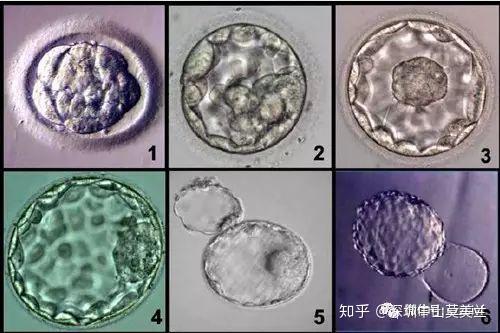 試管嬰兒輔助孵化技術是指什麼可靠嗎