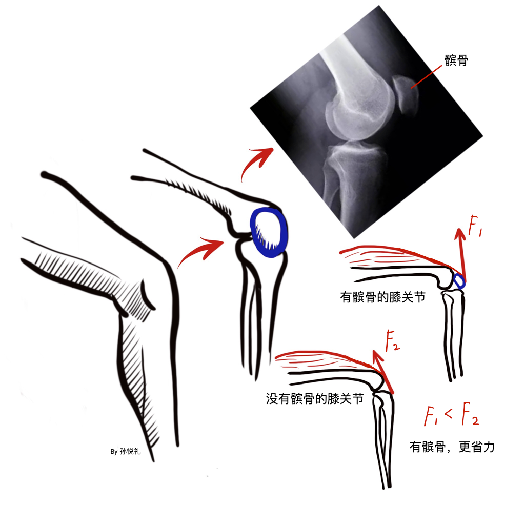 造成膝超伸的习惯站姿不良:站立时习惯将膝盖往后推,使膝关节超出正常