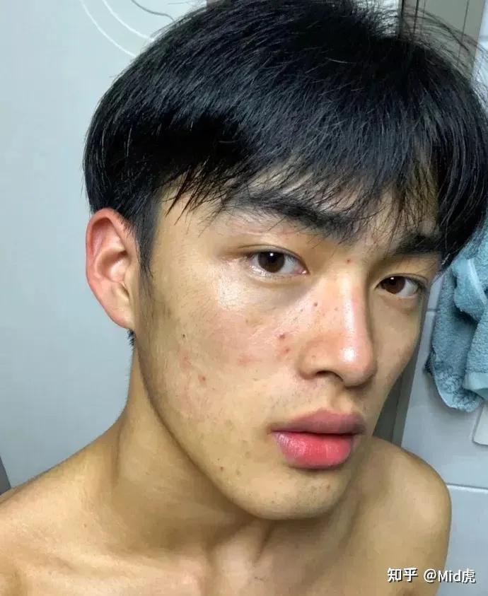 男生如何才能拥有一张干净脸? - 知乎
