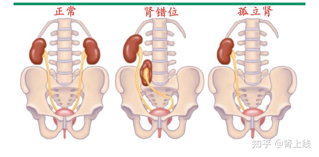 肾区定位标志图片