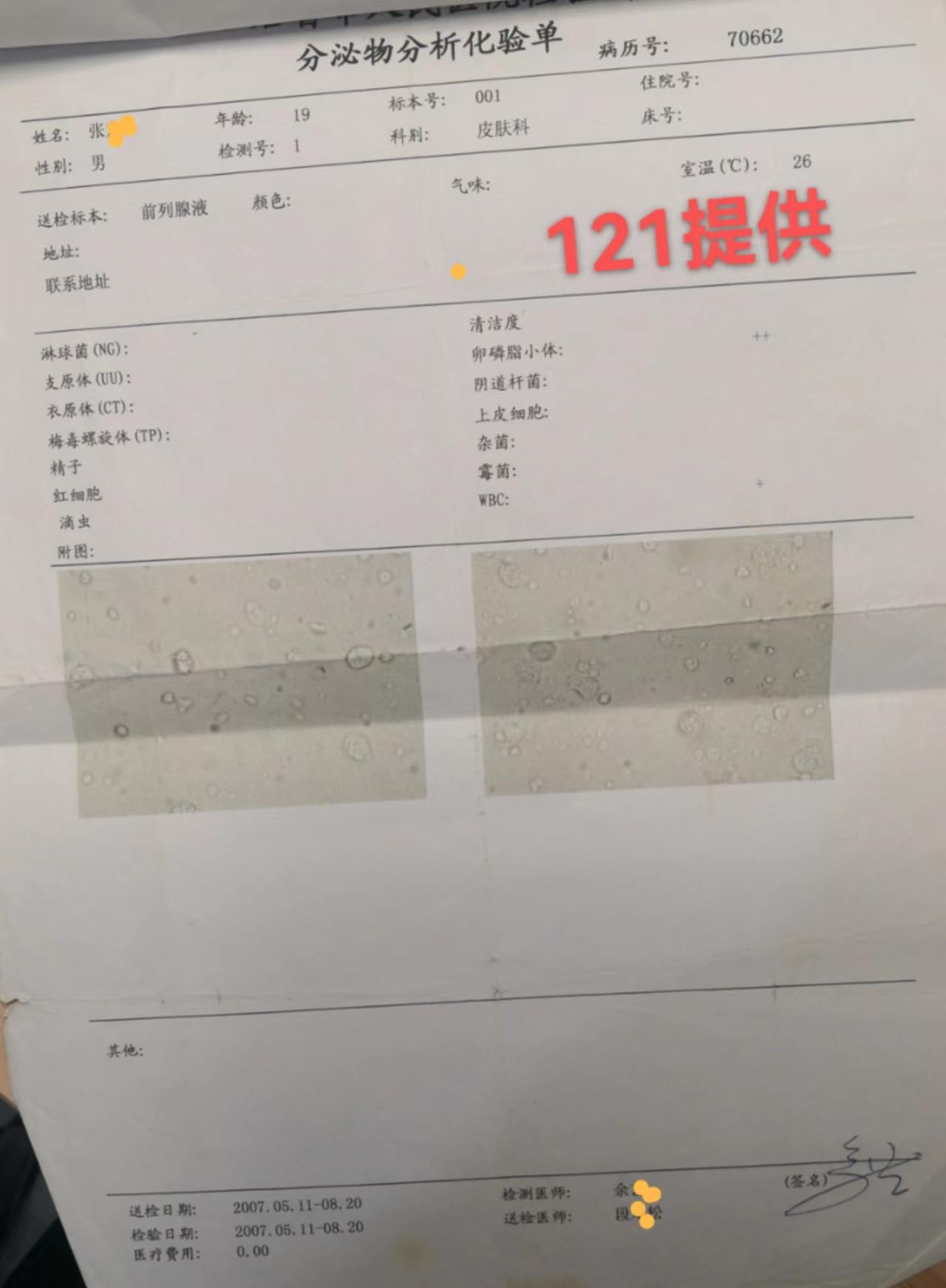 前列腺液细菌培养图片