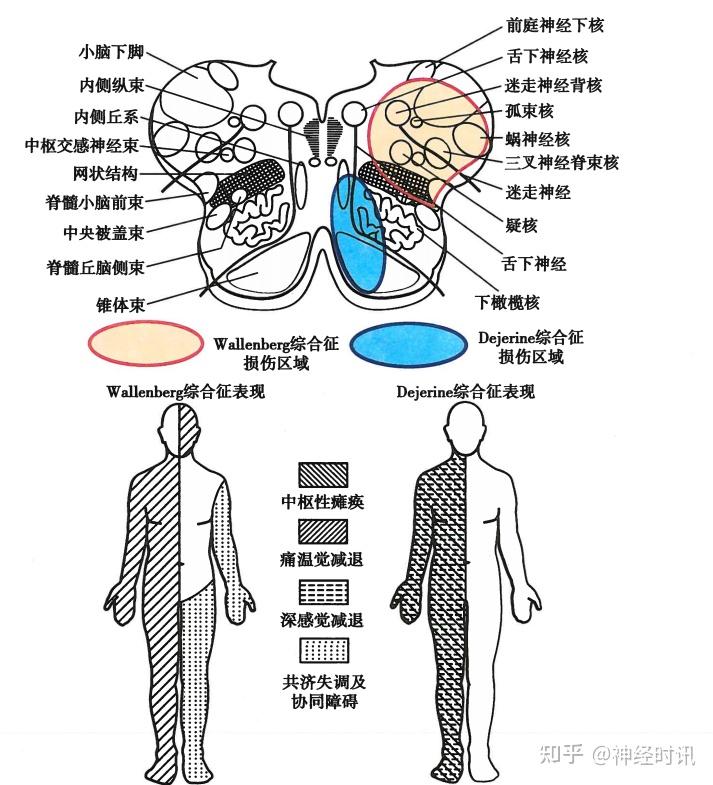 神經解剖學習腦幹乾貨滿滿