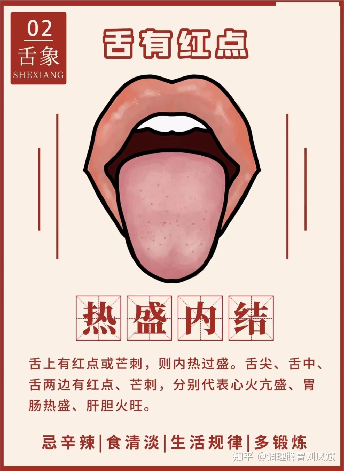 中医教你看舌苔 - 知乎