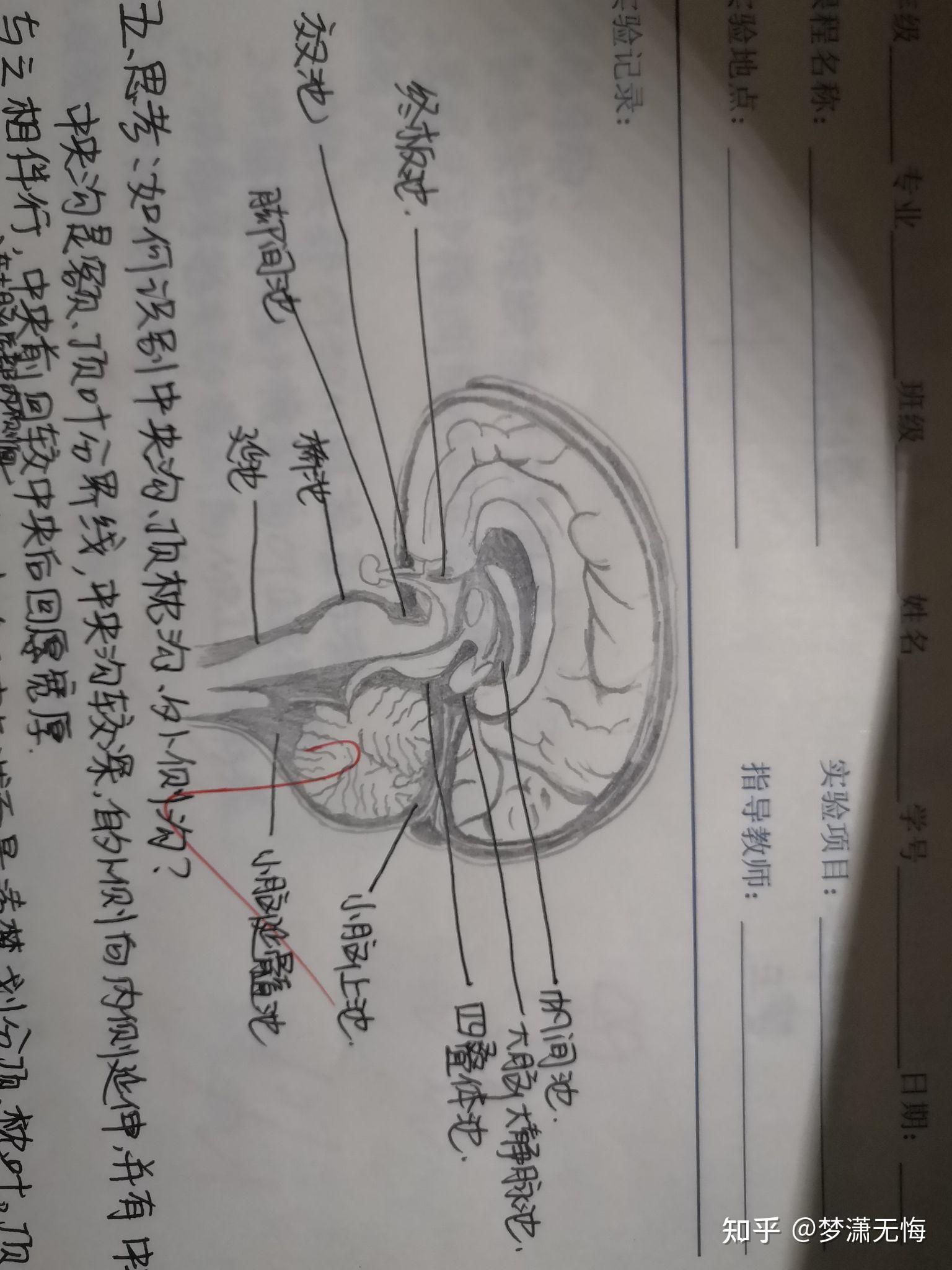 大脑正中矢状面绘图图片