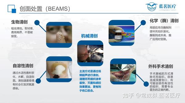 科普知识---如何治愈慢性伤口 - 知乎
