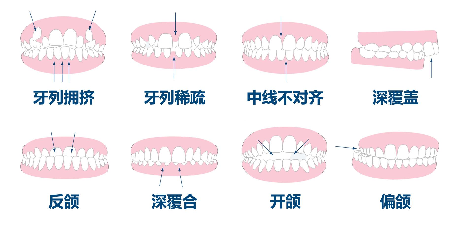 正常牙齿排列,图,顺序(第10页)_大山谷图库