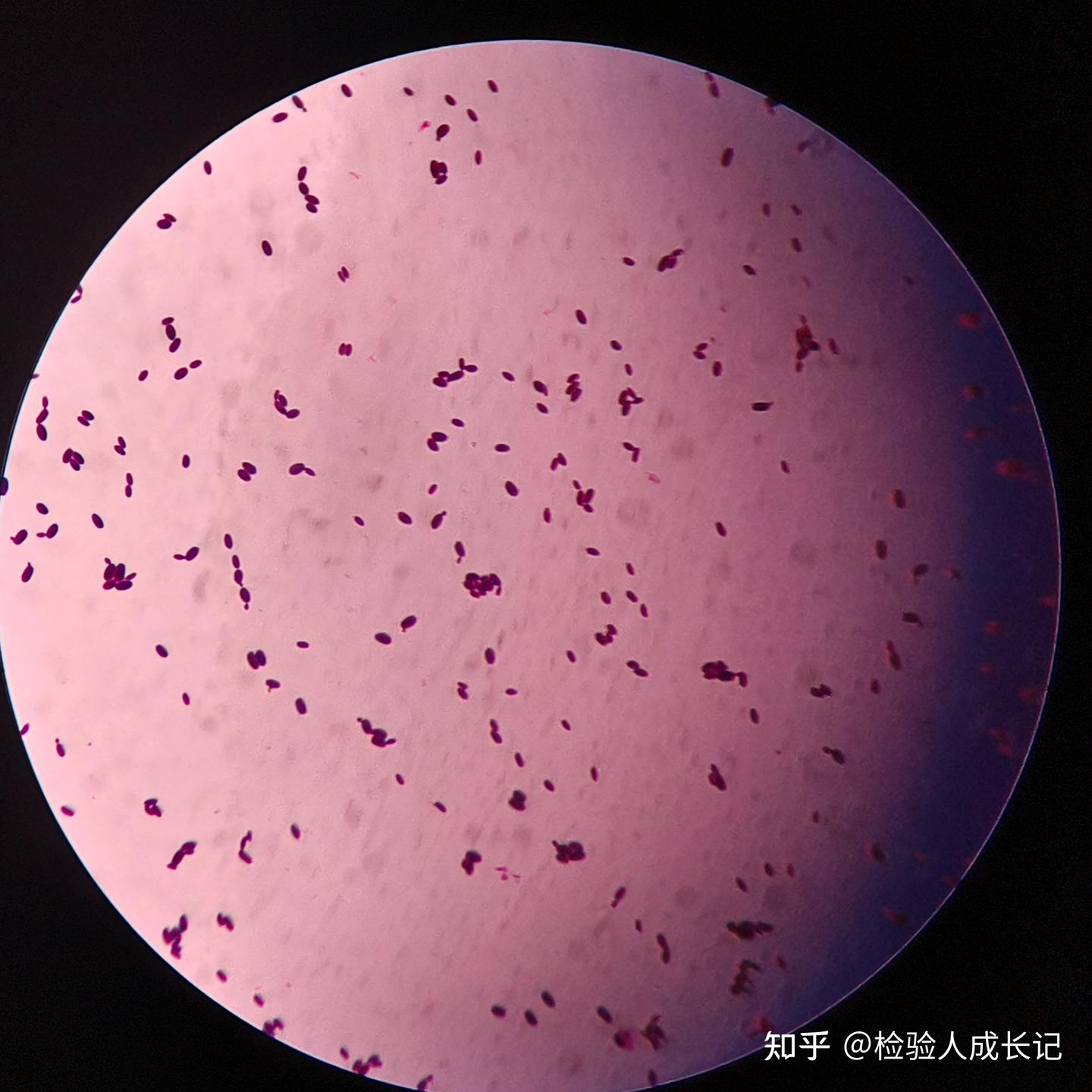 微生物检验常用染色方法合集 - 知乎