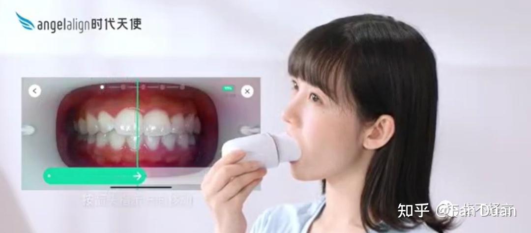 解析时代天使革命性新产品,如何重构隐形正畸(六十一) - 知乎