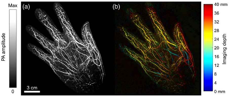 应用讲堂上篇光声成像在生物医学研究