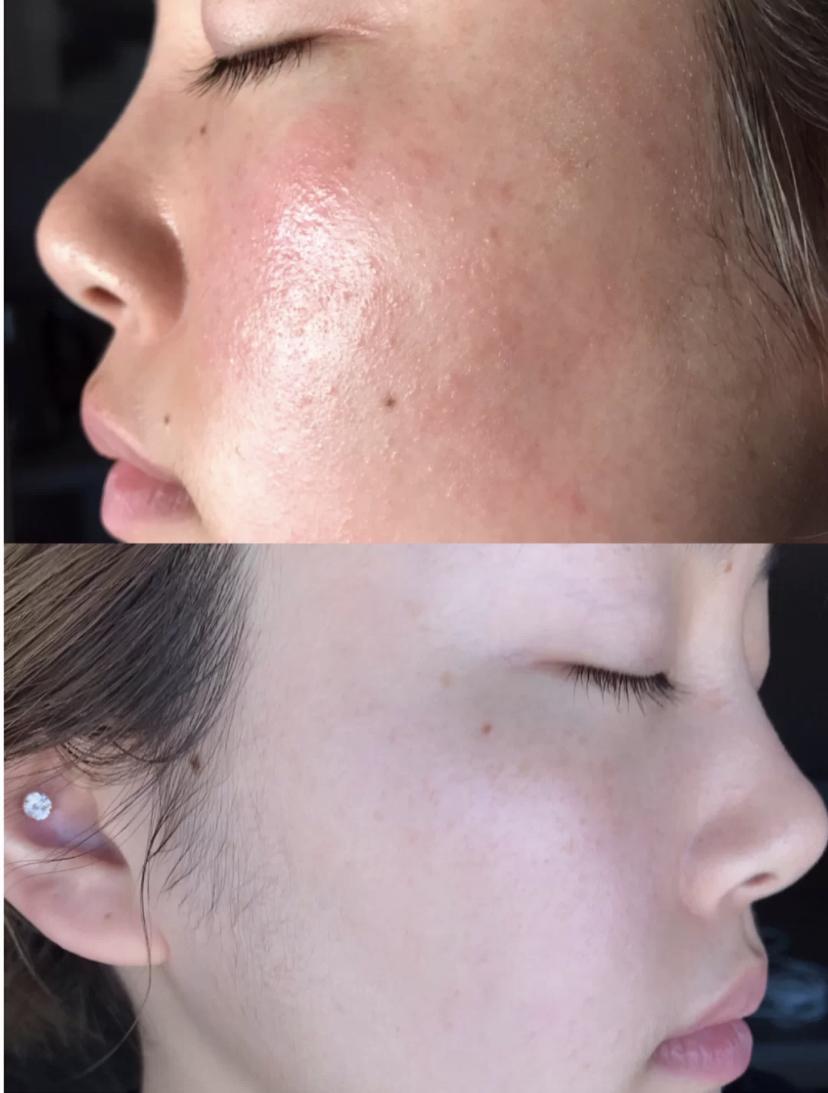 有哪些适合敏感肌的洗面奶好用到飞起