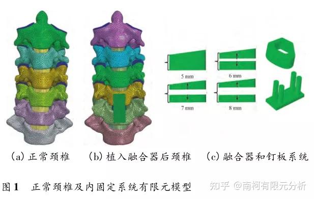 椎间融合器高度对颈椎生物力学影响