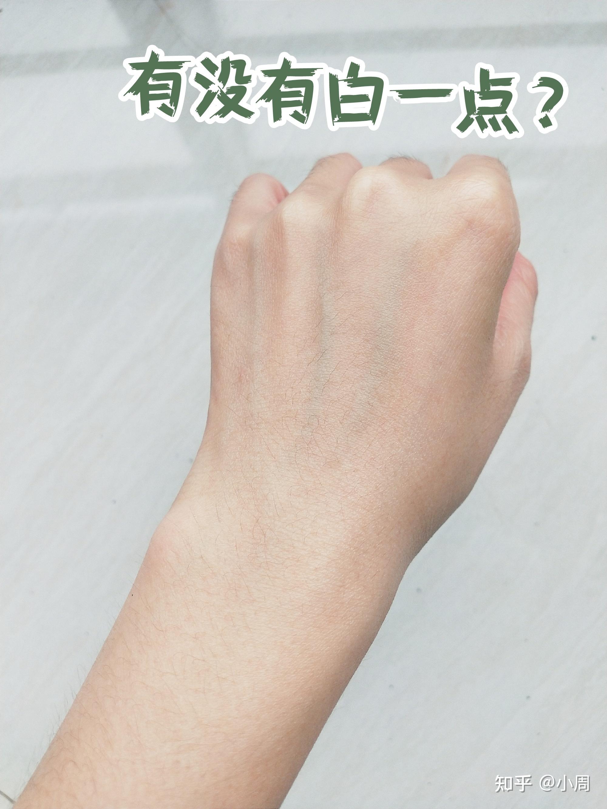上身皮肤像鸡皮(身体上皮肤像鸡皮皮肤是什么原因)
