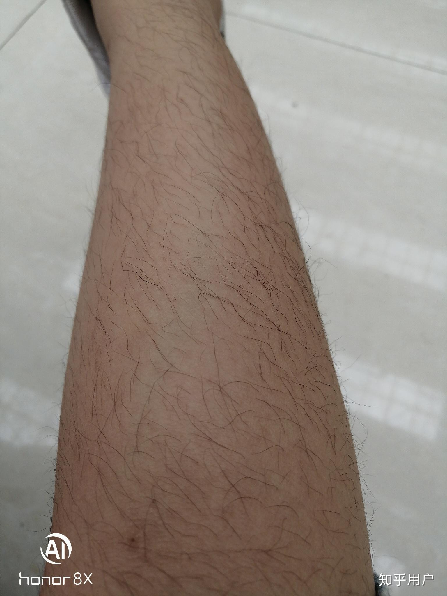 女生腿毛多是一种什么体验?