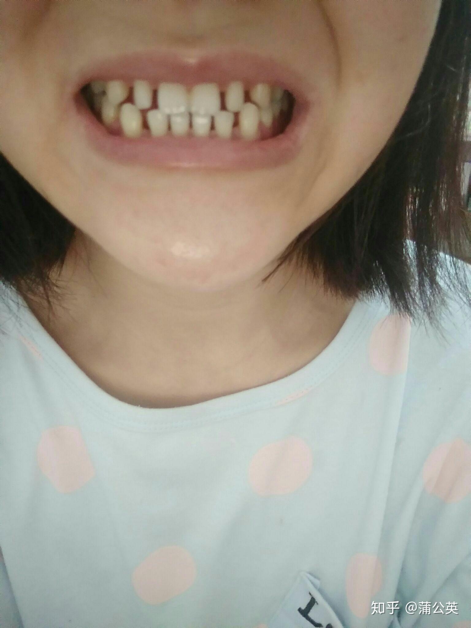 防治儿童牙颌畸形2招--中国数字科技馆