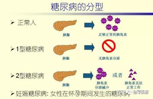 1和2同时满足,或者单纯符合3的患者将被诊断为ii型糖尿病3.
