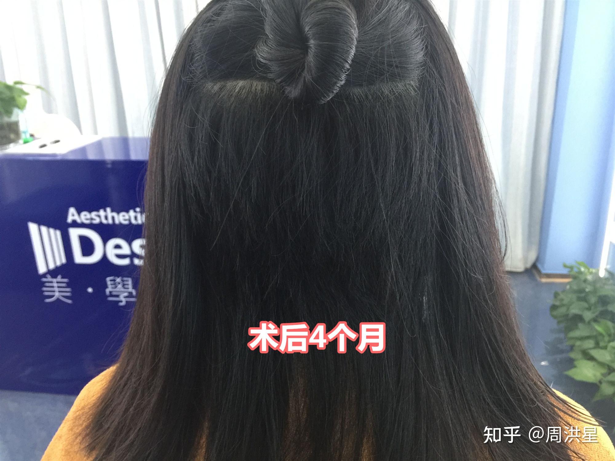 头部后脑勺日式发型日本女士图片素材-编号16512774-图行天下