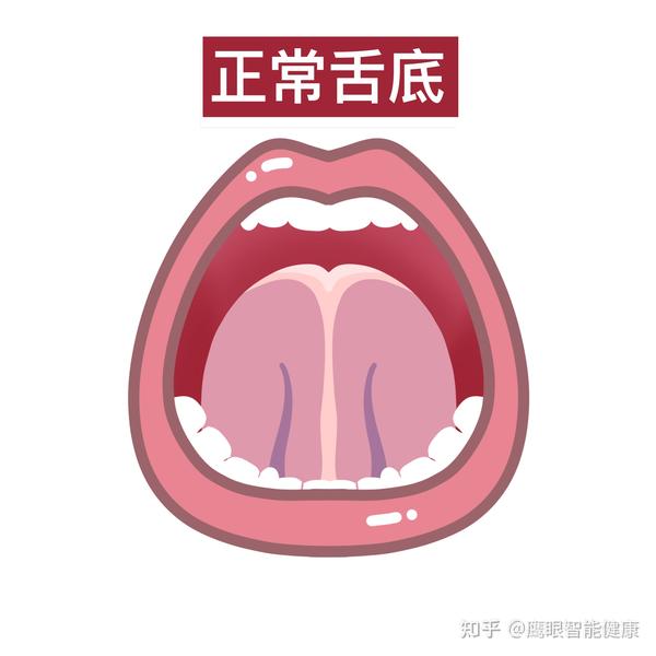 中医看舌底是看的什么?教你一招,轻松判断身体状况 - 知乎