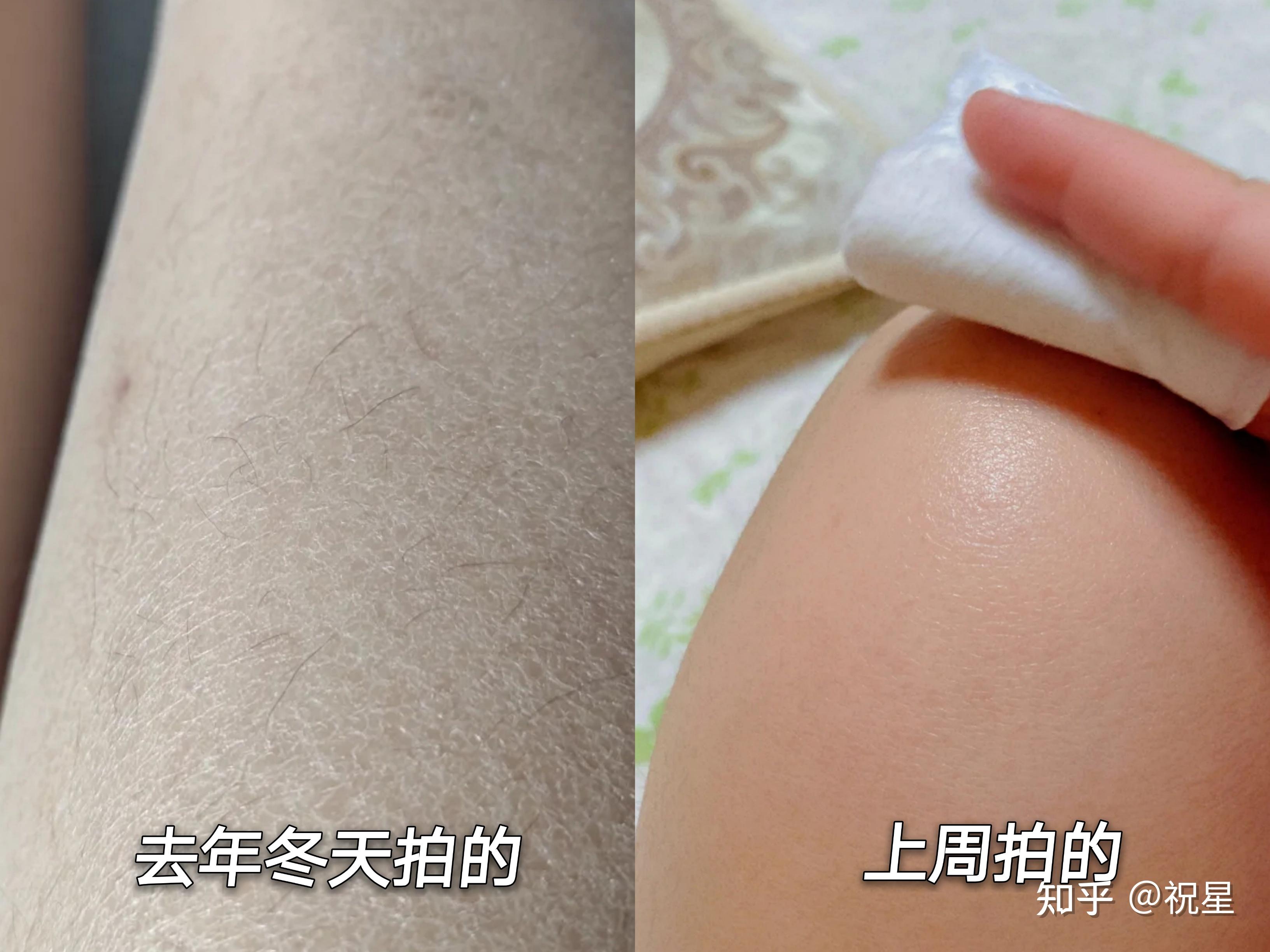 抹身体乳会加速腿毛生长吗(抹身体乳会加速腿毛生长吗男生)