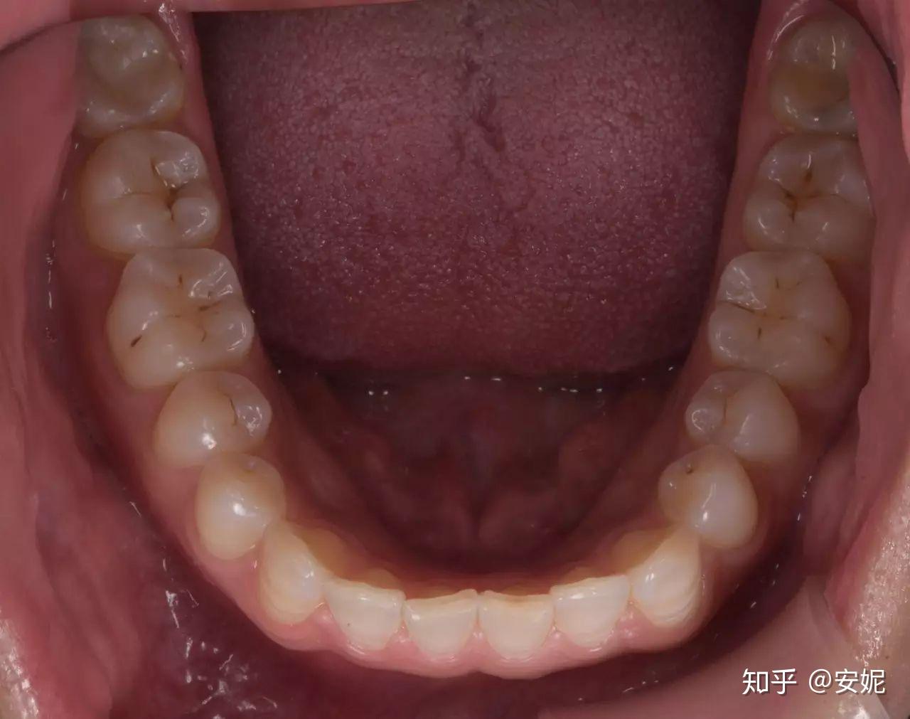 口腔美学摄影dsd设计照片组的拍摄与评估方法