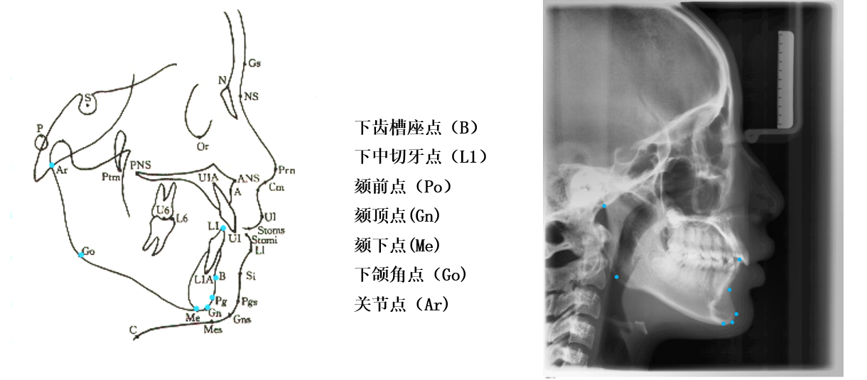 口腔医生须知:头影测量分析 - 知乎