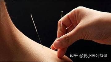 针刺手法(针灸医师必看) - 知乎
