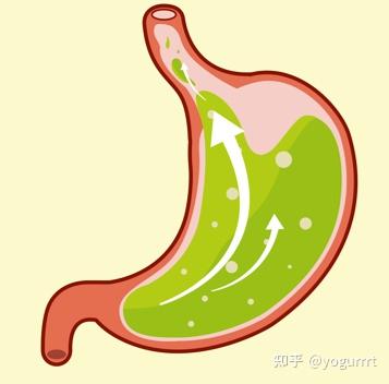 胃酸反流是怎么引起的？医生提醒这几点要注意 - 知乎