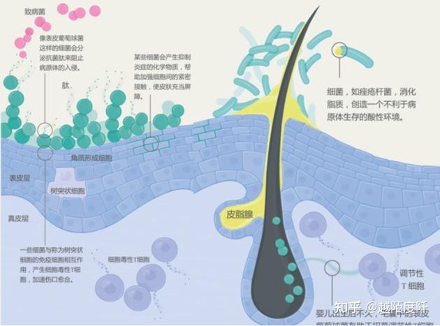 Science Advances:新型微针贴片为痤疮治疗增添新方法 - 知乎