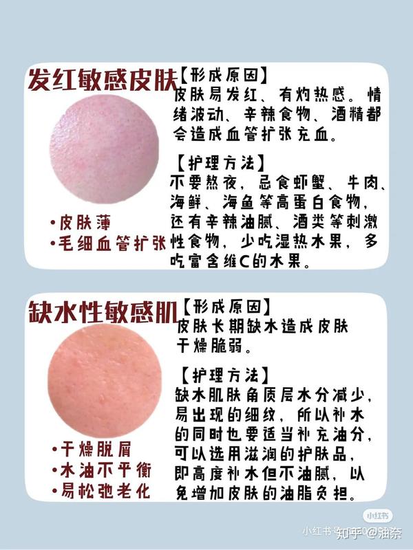如何判断你是否属于敏感肌 敏感肌护肤干货 知乎