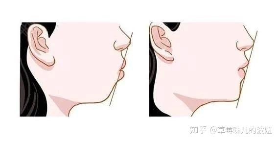 怎样瘦下颌线 v2-ef32464d59a1d2710a41591343d25c12_r.jpg
