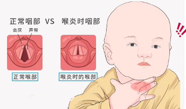 出现这3种情况真很凶险！近期高发家里有娃的要警惕 - 知乎