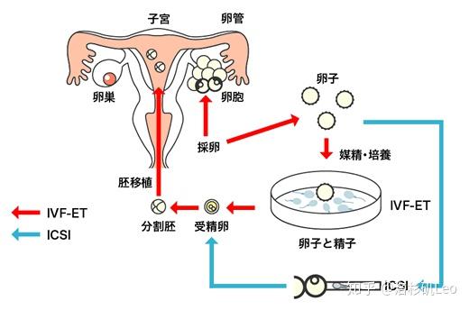 取卵怎么取图解图片