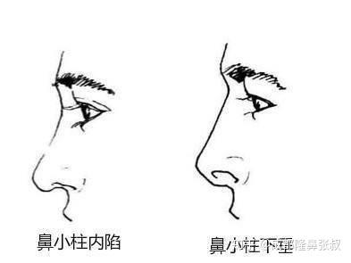 v2-ef75814e4d835757c789a4c890f400f2_b.jpg