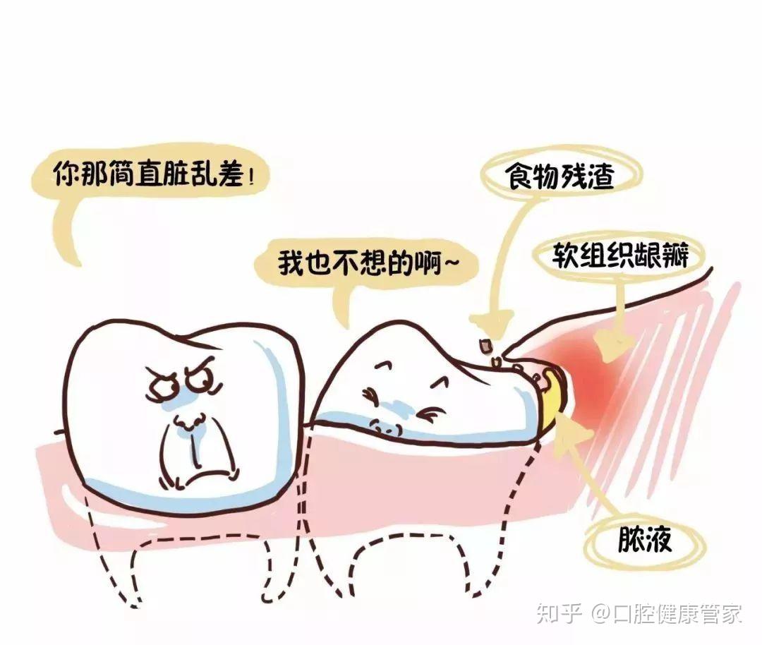 为什么会牙疼？（早晚都刷牙了为什么还会牙痛）-爱康健齿科
