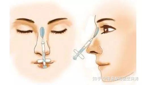 v2-efa5b908abfe92bc3e7da5a64f14aece_r.jpg
