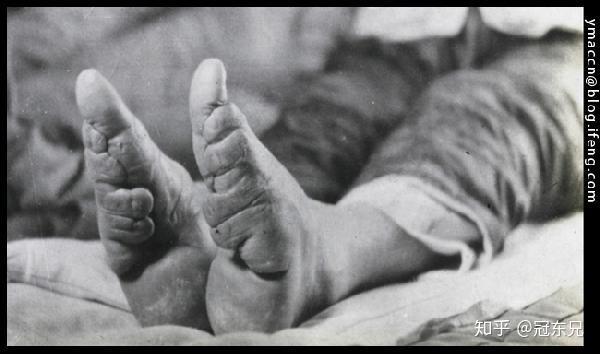 有人说是为了美,因为三寸金莲很漂亮.