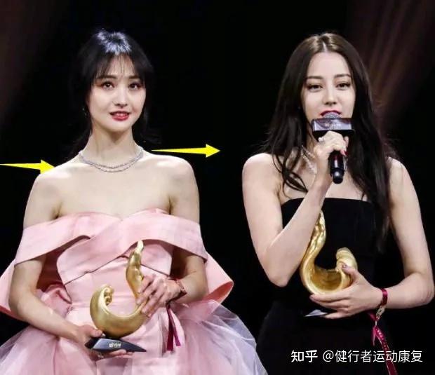 很多经常被夸体态好的明星也有高低肩的问题会觉得体