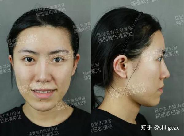女生脸长是一种怎样的体验 知乎 女生脸长是一种怎样的体验 知乎